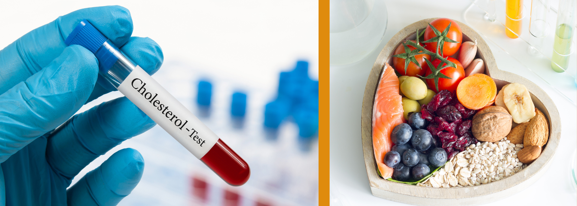 Cholesterol Testing